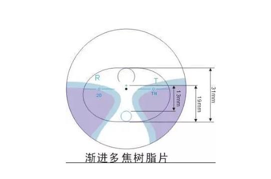 美麗島多焦鏡適合的人群，需要注意的事項(xiàng)