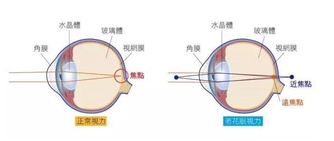 什么是漸進老花鏡